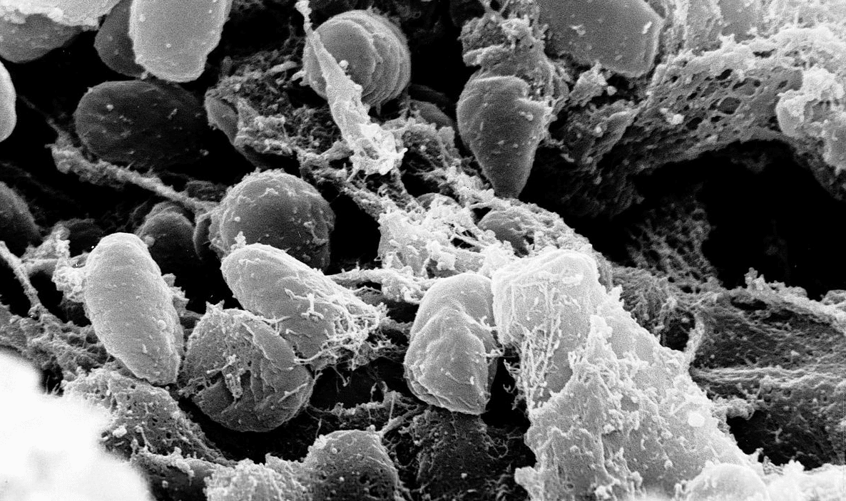 Yersinia pestis